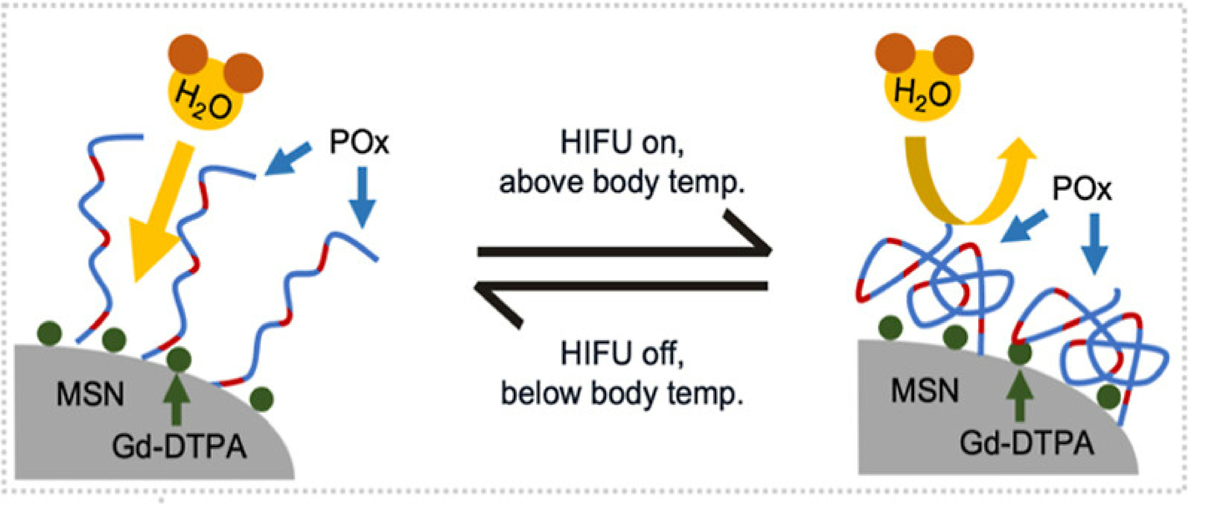 HIFU-triggered nanoparticle activation mechanism