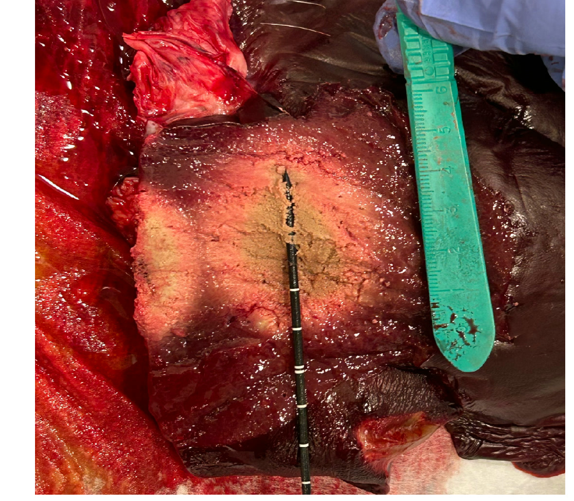 Ex vivo tissue pathology evaluation for microwave ablation