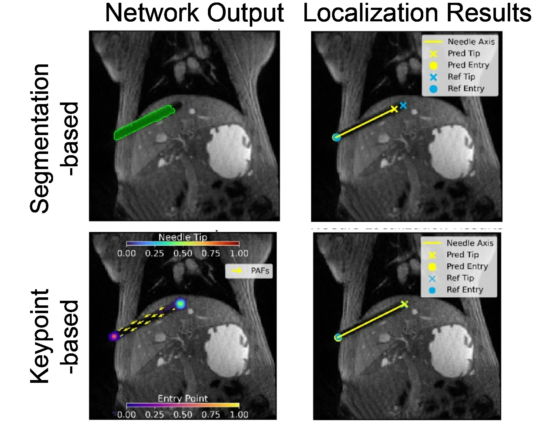 Keypoint detection enables reliable device localization