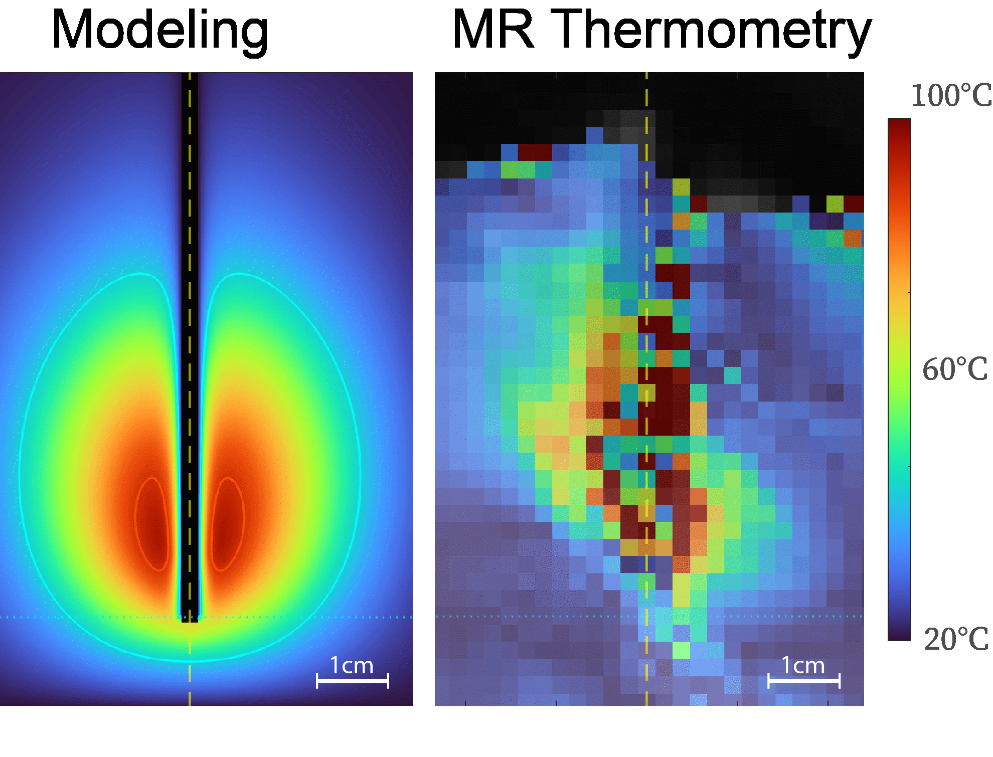 MWA computational modeling with MR thermometry validation