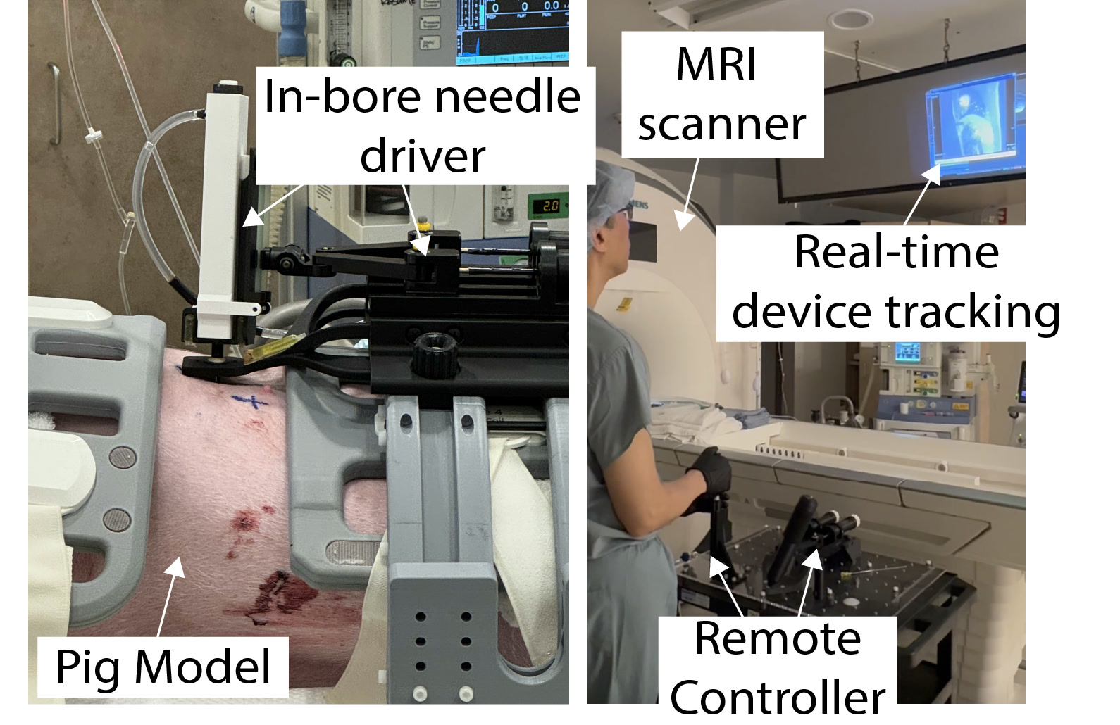 Remote-controlled MRI-compatible robotic prototype for needle interventions